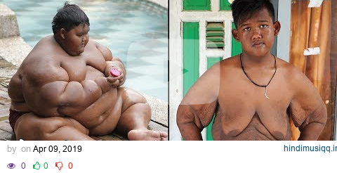 World’s Heaviest Kid Loses 220lbs | TRULY pagalworld mp3 song download